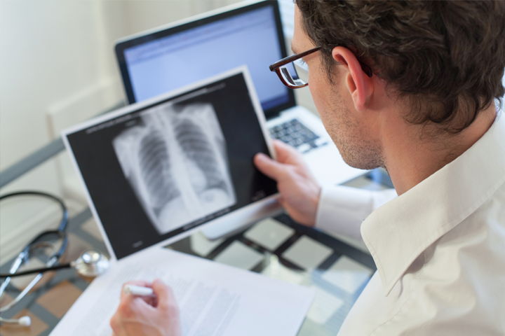Quanto durano i sintomi della polmonite?